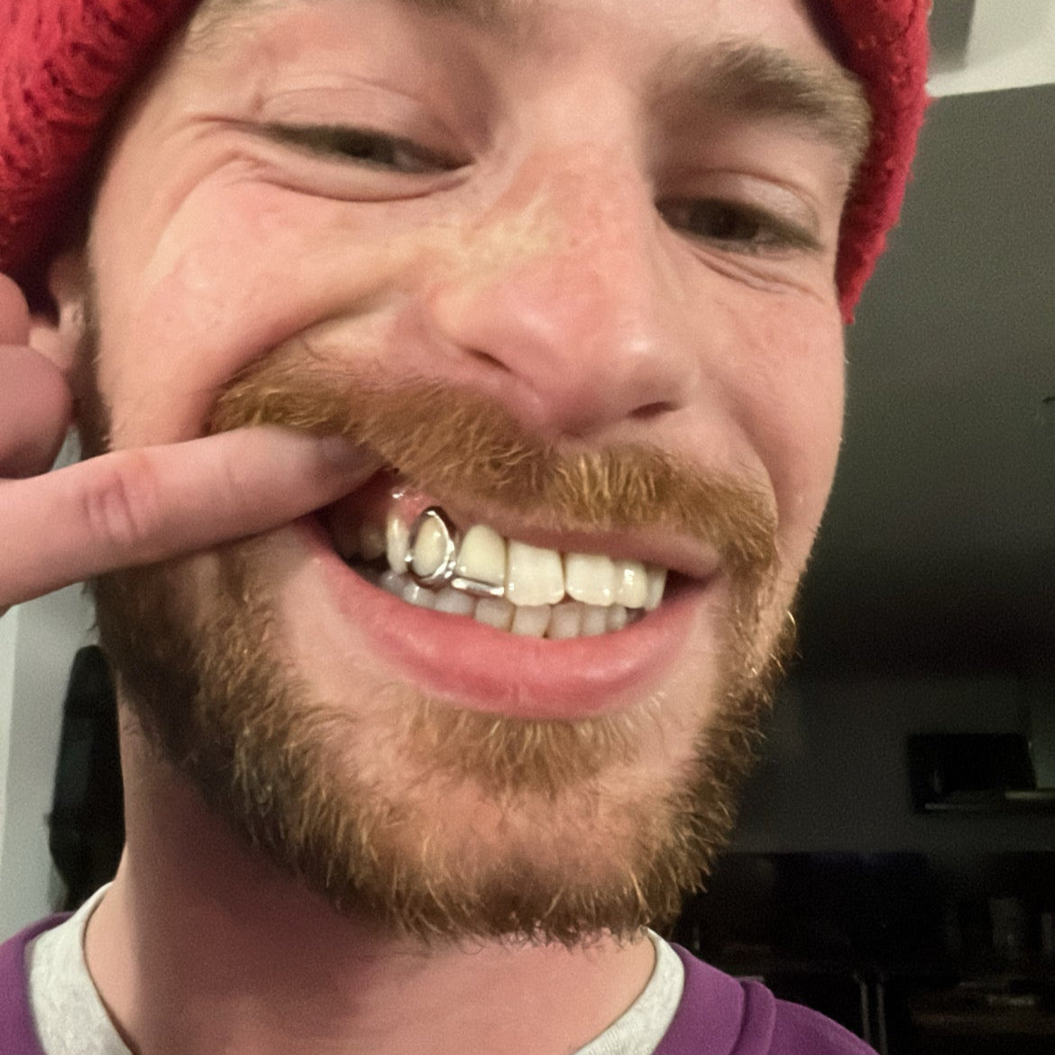 GRILLZ W/ BARRE