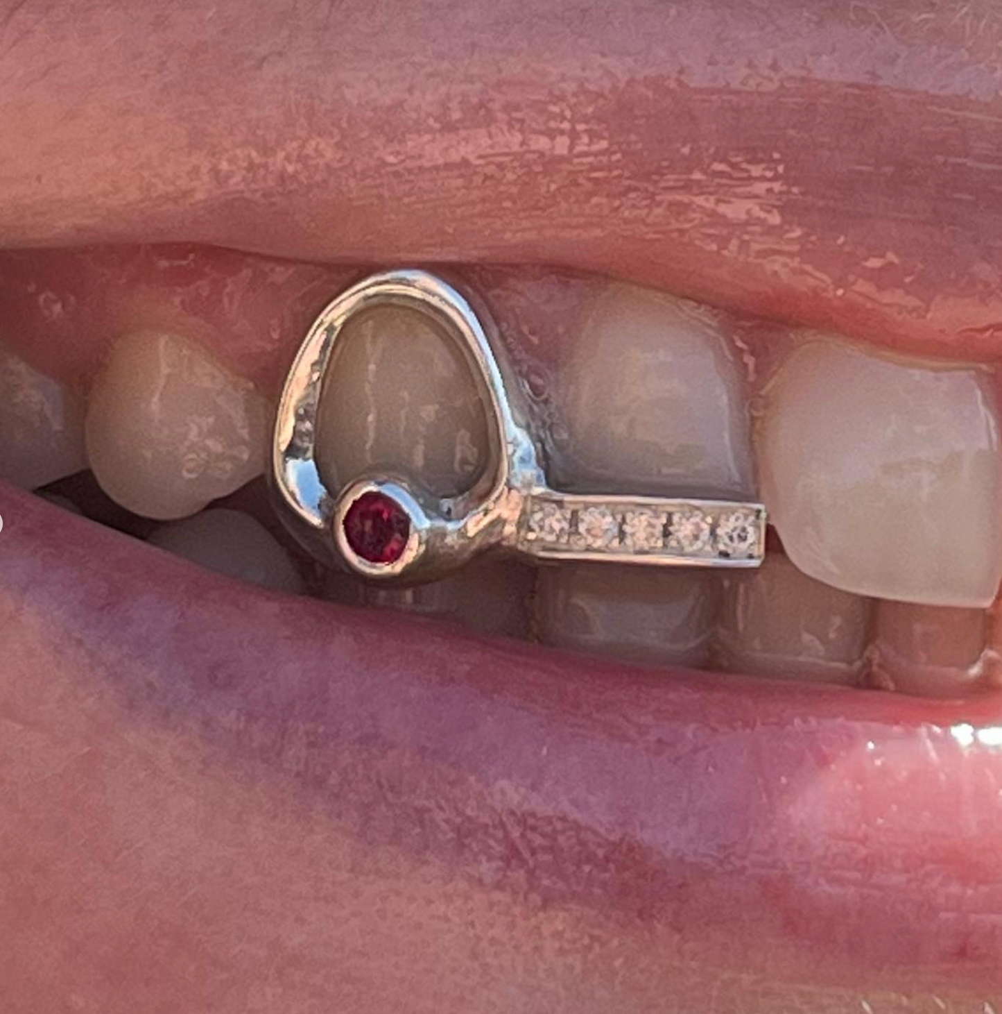 GRILLZ RUBY ROSE W/ BARRE SERTI