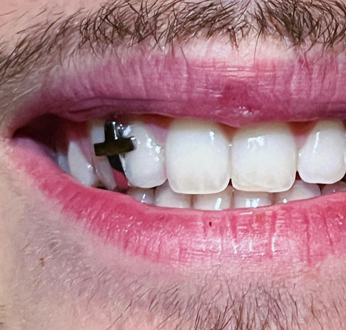 CUSTOM SHAPE GRILLZ