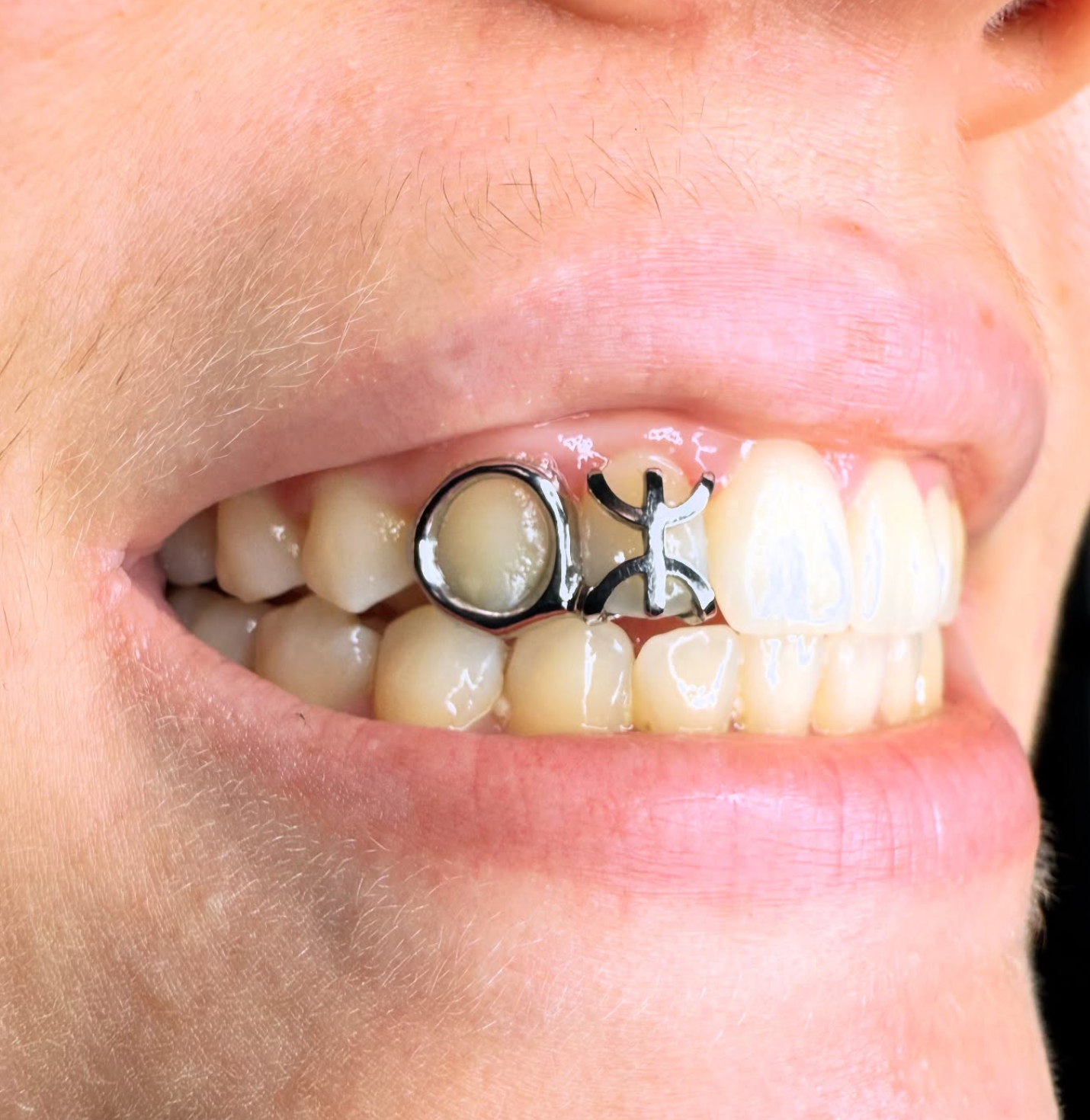 GRILLZ MOTIF 3D+ CONTOUR