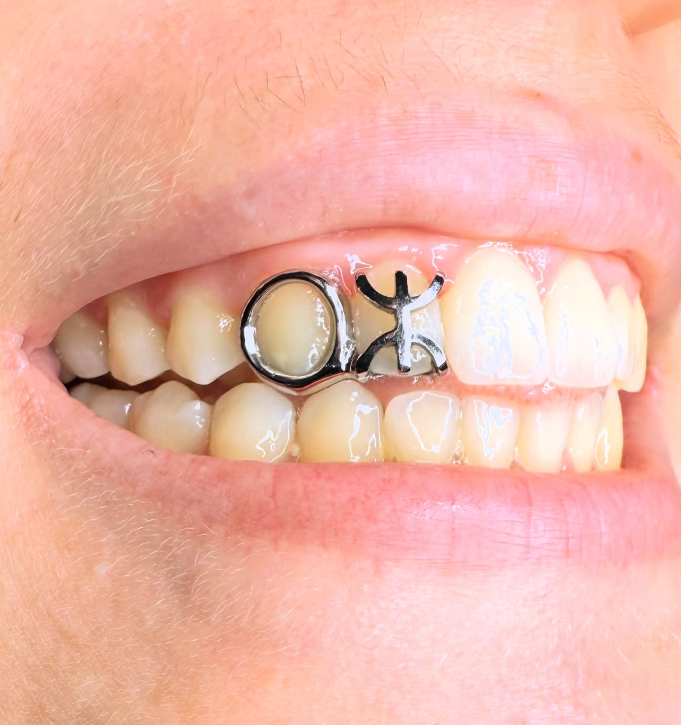 GRILLZ MOTIF 3D+ CONTOUR