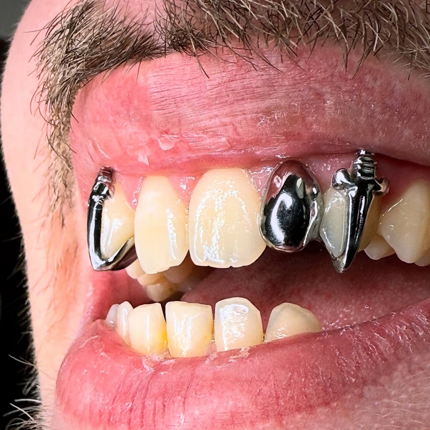 GRILLZ DAGUES + GRILLZ CLASSIQUE