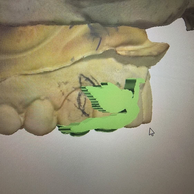 FÉÉ GRILLZ