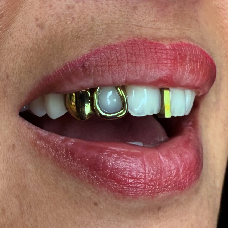 GRILLZ TITANE "GOLD EFFECT"