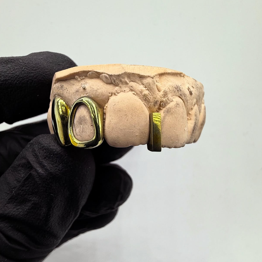 GRILLZ TITANE "GOLD EFFECT"