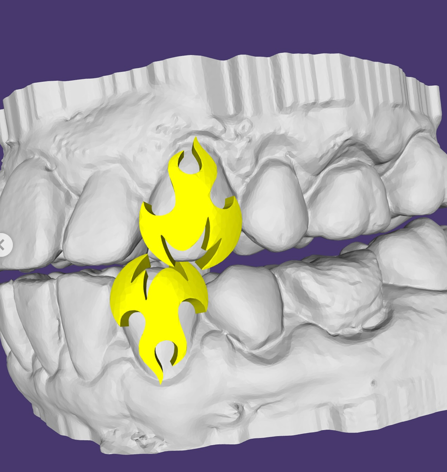 2 GRILLZ FLAMMES 3D