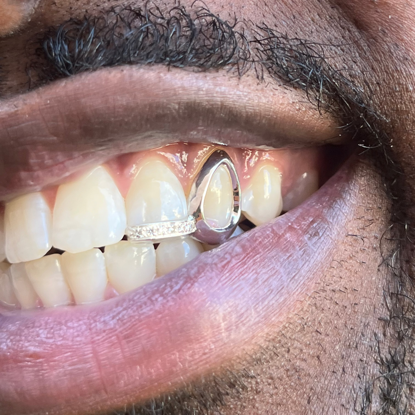 GRILLZ WITH BARRE SERTI
