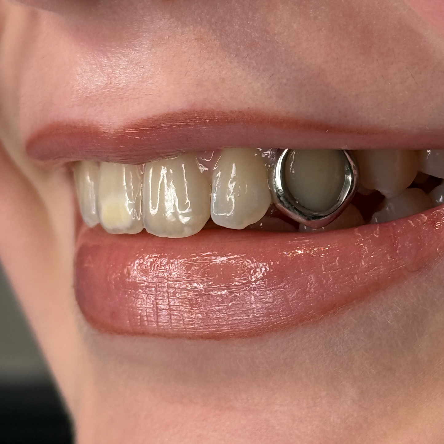 GRILLZ OPEN FACE