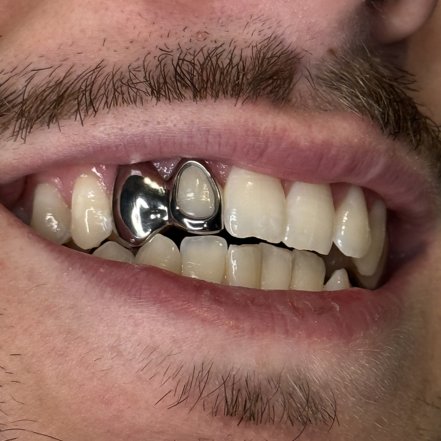 GRILLZ PLEIN + OPEN FACE