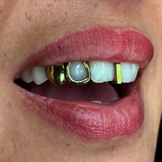 GRILLZ TITANE "GOLD EFFECT"
